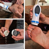 Electric Calluses Remover