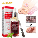LANBENA Nail Repair Essence Serum 12ml Fungal Nail Treatment Remove Onychomycosis Toe Nourishing Brighten Hand Foot Skin Care