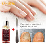 LANBENA Nail Repair Essence Serum 12ml Fungal Nail Treatment Remove Onychomycosis Toe Nourishing Brighten Hand Foot Skin Care